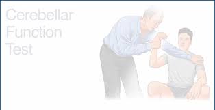 Image result for Cerebellar Function Test