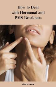 Hormonal Acne Why Do I Break Out Before My Period Skincare Com By L Oreal In 2020 Hormonal Acne Hormonal Acne Treatment Hormones
