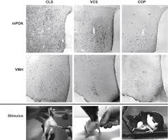 Removing excess skin, exposing the head. Clitoris An Overview Sciencedirect Topics