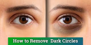 We did not find results for: Dark Circles Under Eyes