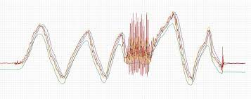 Kalman Filter Vs Complementary Filter