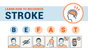 A stroke can happen in two main ways: Learn How To Recognize A Stroke Rockledge Regional Medical Center