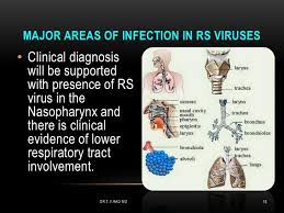 The length of the period between the seasonal peak incidences of rs virus infection varied. Respiratory Syncytial Virus