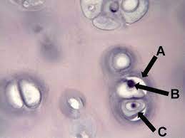 Hyaline Cartilage A Edge Of The Lacuna B Nucleus Of A Chondrocyte C Chondrocyte Nursing School Info Study Of Tissues School Info