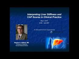 2017 05 03 12 00 Interpreting Liver Stiffness And Cap Scores In Clinical Practice