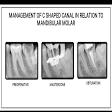 RCT , root canal treatment, dental clinic nea, dental pain product image