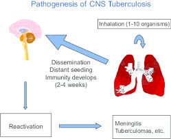 Therefore, it is important to know about the nervous system entirely. 1 Pathogenesis Of Central Nervous System Tuberculosis Download Scientific Diagram