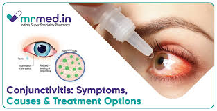 Image result for Conjunctivitis Resources