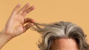 Matthew weiner is an author and bariatric surgeon who specializes in the treatment of obesity. Hair Transplant 10 Years After Operation Mycapil