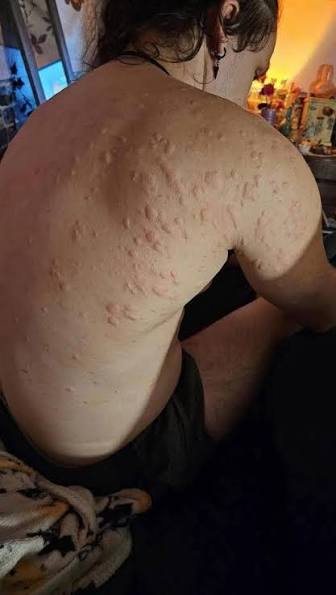 These are the consequences of sleeping with the…See below