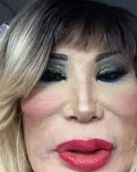 She was a famous actress who entertained numerous presidents and appeared  in around 100 films. However, one tragic mistake drastically altered her  appearance, leaving her unrecognizable... Check the comments to discover her
