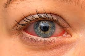 Cosa Fare per la Salute degli Occhi | MBenessere