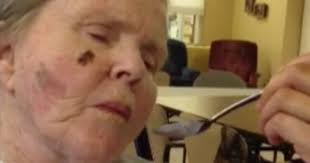Care home force-feeding senior against her will, family says