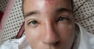 A Face Only a Mother Could Love