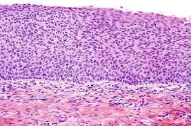Check spelling or type a new query. Benign Diseases Of The Cervix Springerlink