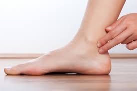 Posterior Tibial Tendon Injury Mydr Com Au