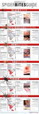 Spider Bites Guide Dangerous U S Spiders This Graphic