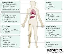 Nature Reviews Disease Primers On Twitter Crohn S Disease Is Associated With Various Manifestations And Complications Beyond The Gastrointestinal Tract Https T Co Zwvfamm2ey Crohns Ibd Https T Co G8z8jixwxb