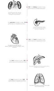 Organ Transplant Center Timeline University Of Iowa