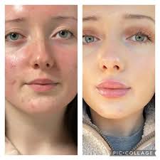 THE BEST 10 Medical Spas near ARMONK, NY 10504