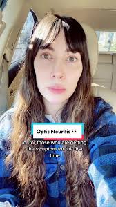 Black Floaters in Eye Multiple Sclerosis