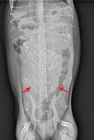 Current international guidelines recommend for the normal fetal heart rate (fhr) baseline different ranges of 110 to 150 beats per minute (bpm) or 110 to 160 bpm. Canine Dystocia Clinician S Brief
