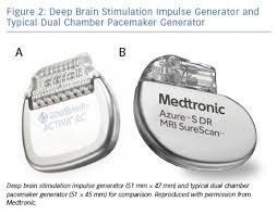 If these impulses are disrupted, you may need an artificial pacemaker. Pacemaker And Defibrillator Implantation And Programming In Patients With Deep Brain Stimulation Aer Journal