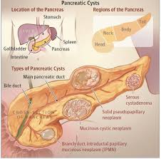Pin By Margarete Muller On Rn Diagnostic Medical Sonography Gastroenterology Medical Knowledge