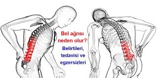 Bel Agrisi Nedir Neden Olur Belirtileri Ve Tedavi Yontemleri