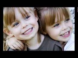 أجمل صور التوائم المتشابهة والغير متشابهة يوتيوب baby face hi friends face