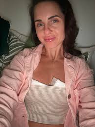 Herbal healing after explant surgery guide