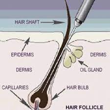 Based on a personal and confidential consultation, your electrologist will design a treatment plan that addresses your specific hair removal needs. Electrolysis Permanent Hair Removal At Beauty Works Spa Belleville Ontario
