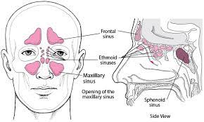 Paranasal Sinus Cancer Ear Nose And Throat Disorders Msd Manual Consumer Version