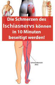 Die Schmerzen Des Ischiasnervs Konnen In 10 Minuten Beseitigt Werden Tippsundtricks Die Schmerzen Des Ischiasnervs Kon Health Physical Health Health Benefits