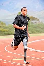 Custom prosthetic leg covers, designed and manufactured in canada. Prosthesis Wikipedia