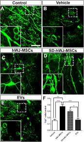 Maybe you would like to learn more about one of these? Human Mesenchymal Stem Cell Therapy Promotes Retinal Ganglion Cell Survival And Target Reconnection After Optic Nerve Crush In Adult Rats Stem Cell Research Therapy Full Text