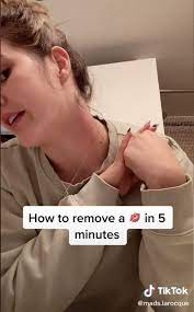 How To Get Rid Of Hickies