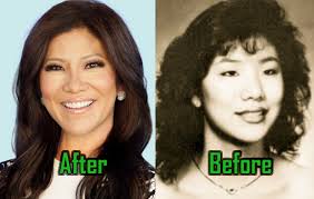 The staff of plastic surgery services congratulates board certified plastic. Julie Chen Plastic Surgery To Fight Racism Before After Photos Celebritysurgeryicon