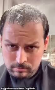 When it comes to hair replacement systems, xtrands+® is amongst the world's best. Hairdresser Goes Viral With Videos Showing Bald Men Transformed By Non Surgical Hair Replacements Daily Mail Online