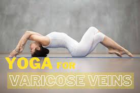 Yoga poses for varicose veins. Yoga For Varicose Veins 7 Poses Exercises That Can Help Manage Fitsri