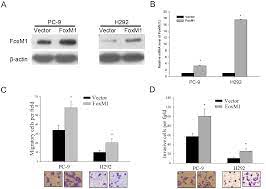 What to do if your child was bitten by a rabid animal. Plos One Foxm1 Is Associated With Poor Prognosis Of Non Small Cell Lung Cancer Patients Through Promoting Tumor Metastasis