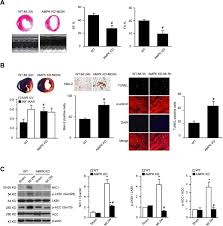 Cardioprotective Actions Of Notch1 Against Myocardial Infarction Via Lkb1 Dependent Ampk Signaling Pathway Sciencedirect