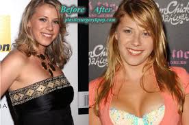 17.06.2020 · jodie sweetin plastic surgery. Jodie Sweetin Plastic Surgery Breast Implants Before After Picture