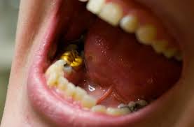 We did not find results for: Cavity Under Crown All You Need To Know About Crowned Tooth Pain