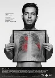 Late stage 4b lung cancer that has spread to other organs may also cause the following symptoms: Egfr Positive Uk On Twitter Jaber Was Diagnosed With Advanced Lung Cancer At 37 Never Smoking Lung Cancer Is Now The Eighth Most Common Cause Of Cancer Related Death In The Uk Lunguk Pcrsuk