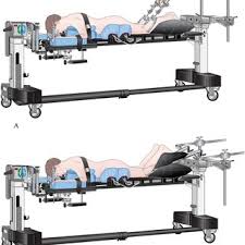 Drawing Of Patient Positioning On The Osi Spine Table The Head Is Download Scientific Diagram