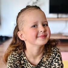 Fundraiser by Nathalie Hancock : Help Redefine Beauty: Support People with  Alopecia