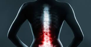 Trust your recovery to the experts! Herniated Disc Ruptured Or Slipped Spinal Disc Hss