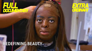 My Extreme Life: Redefining Beauty