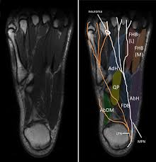 Feet and ankles ankle muscle anatomy of foot muscles of foot muscles foot foot muscles anatomy muscle composite video showing multiple mri images including: Magnetic Resonance Imaging Mri Image Showing Foot Muscles And Download Scientific Diagram
